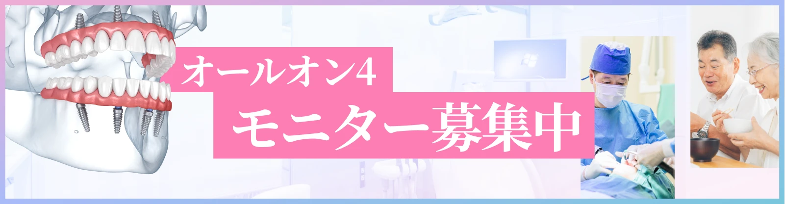 オールオン４モニター募集中